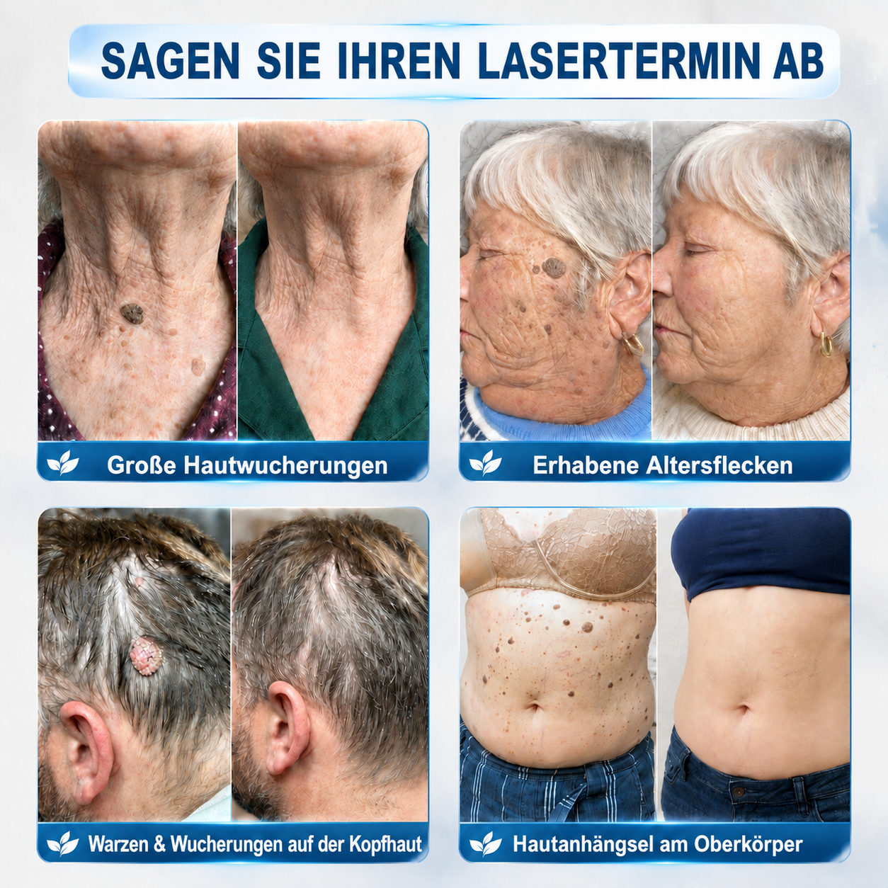 𝐇𝐈𝐒𝐊𝐈𝐍®👩‍⚕️ 𝟕-𝐓𝐚𝐠𝐞-𝐇𝐚𝐮𝐭𝐚𝐧𝐡ä𝐧𝐠𝐬𝐞𝐥- & 𝐅𝐥𝐞𝐜𝐤𝐞𝐧𝐞𝐧𝐭𝐟𝐞𝐫𝐧𝐞𝐫 – 𝐅𝐨𝐫𝐭𝐬𝐜𝐡𝐫𝐢𝐭𝐭𝐥𝐢𝐜𝐡𝐞𝐫 𝐑𝐨𝐥𝐥-𝐨𝐧-𝐒𝐭𝐢𝐟𝐭 𝐳𝐮𝐫 𝐬𝐜𝐡𝐦𝐞𝐫𝐳𝐟𝐫𝐞𝐢𝐞𝐧 𝐮𝐧𝐝 𝐧𝐚𝐫𝐛𝐞𝐧𝐟𝐫𝐞𝐢𝐞𝐧 𝐄𝐧𝐭𝐟𝐞𝐫𝐧𝐮𝐧𝐠 𝐯𝐨𝐧 𝐇𝐚𝐮𝐭𝐮𝐧𝐫𝐞𝐢𝐧𝐡𝐞𝐢𝐭𝐞𝐧