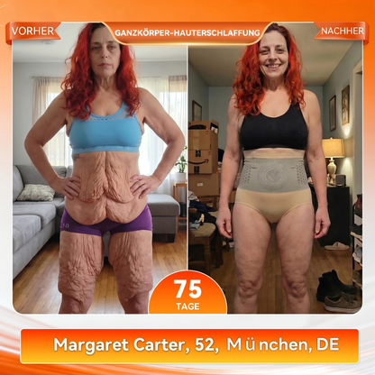 Offizieller Markenstore 💎𝑨𝑳𝑳𝒀𝑩𝑬𝑬® 2026 4-in-1 Moringa & Berberin Mikro-Partikel Form- & Fettverbrennungs-Shorts