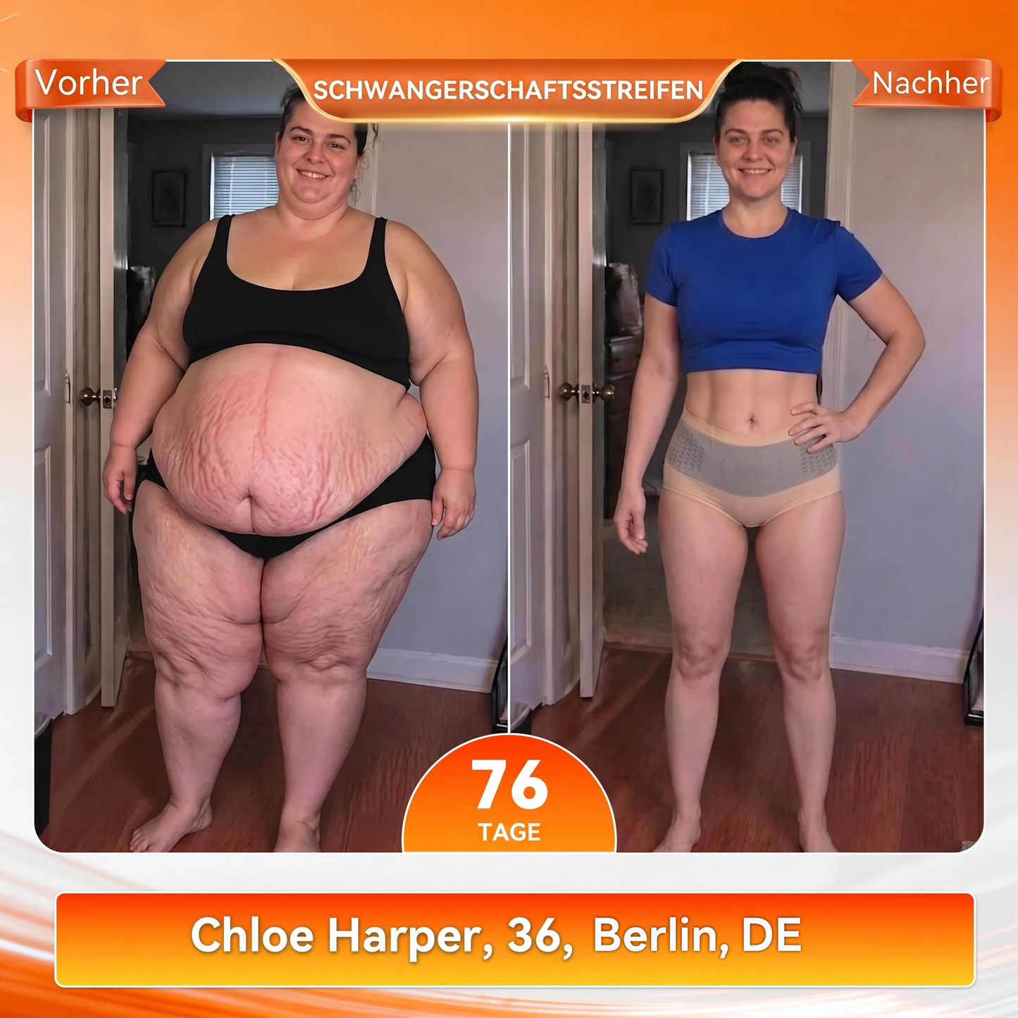 Offizieller Markenstore 💎𝑨𝑳𝑳𝒀𝑩𝑬𝑬® 2026 4-in-1 Moringa & Berberin Mikro-Partikel Form- & Fettverbrennungs-Shorts