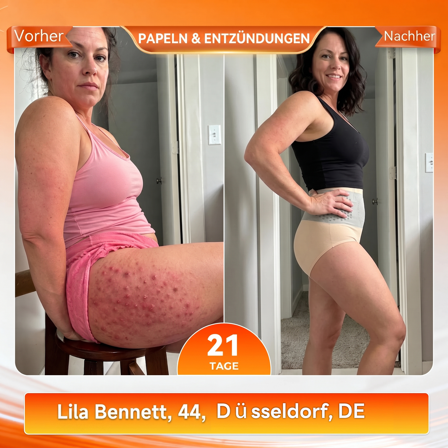 Offizieller Markenstore 💎𝑨𝑳𝑳𝒀𝑩𝑬𝑬® 2026 4-in-1 Moringa & Berberin Mikro-Partikel Form- & Fettverbrennungs-Shorts