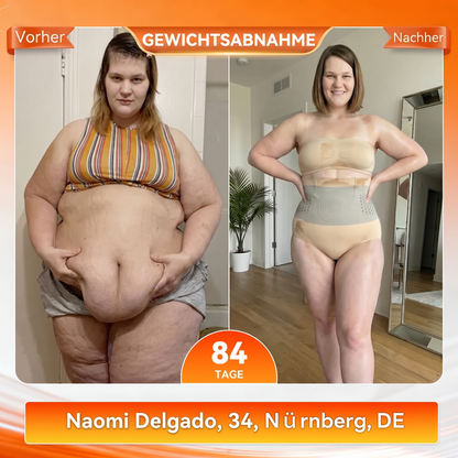 Offizieller Markenstore 💎𝑨𝑳𝑳𝒀𝑩𝑬𝑬® 2026 4-in-1 Moringa & Berberin Mikro-Partikel Form- & Fettverbrennungs-Shorts