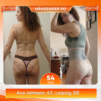 Offizieller Markenstore 💎𝑨𝑳𝑳𝒀𝑩𝑬𝑬® 2026 4-in-1 Moringa & Berberin Mikro-Partikel Form- & Fettverbrennungs-Shorts