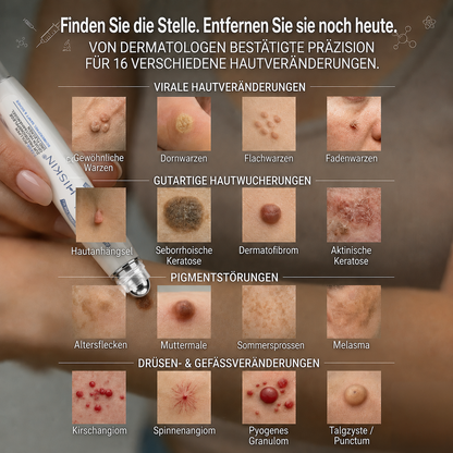 𝐇𝐈𝐒𝐊𝐈𝐍®👩‍⚕️ 𝟕-𝐓𝐚𝐠𝐞-𝐇𝐚𝐮𝐭𝐚𝐧𝐡ä𝐧𝐠𝐬𝐞𝐥- & 𝐅𝐥𝐞𝐜𝐤𝐞𝐧𝐞𝐧𝐭𝐟𝐞𝐫𝐧𝐞𝐫 – 𝐅𝐨𝐫𝐭𝐬𝐜𝐡𝐫𝐢𝐭𝐭𝐥𝐢𝐜𝐡𝐞𝐫 𝐑𝐨𝐥𝐥-𝐨𝐧-𝐒𝐭𝐢𝐟𝐭 𝐳𝐮𝐫 𝐬𝐜𝐡𝐦𝐞𝐫𝐳𝐟𝐫𝐞𝐢𝐞𝐧 𝐮𝐧𝐝 𝐧𝐚𝐫𝐛𝐞𝐧𝐟𝐫𝐞𝐢𝐞𝐧 𝐄𝐧𝐭𝐟𝐞𝐫𝐧𝐮𝐧𝐠 𝐯𝐨𝐧 𝐇𝐚𝐮𝐭𝐮𝐧𝐫𝐞𝐢𝐧𝐡𝐞𝐢𝐭𝐞𝐧
